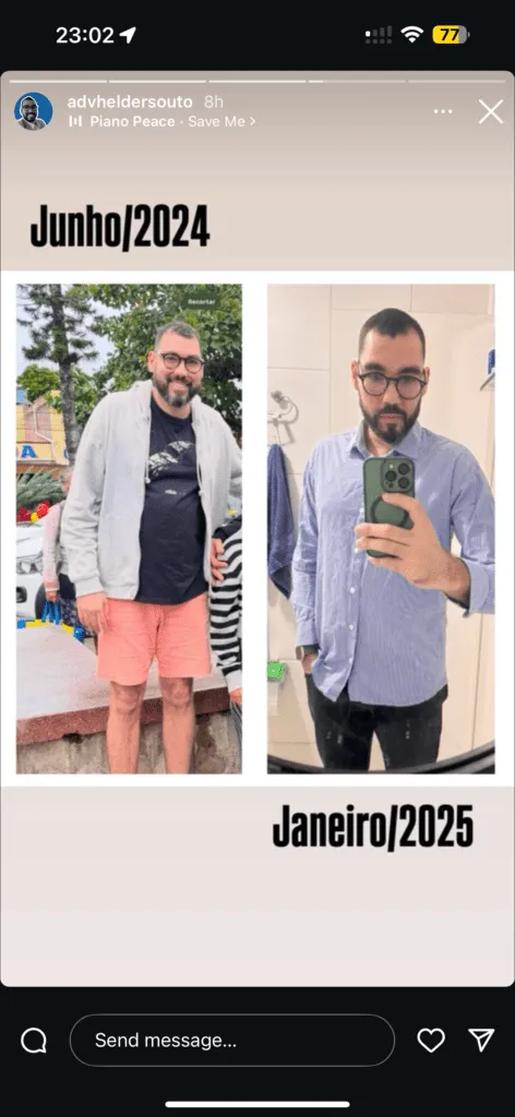 Antes e Depois